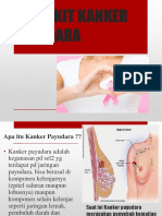 Penyakit Kanker Payudara