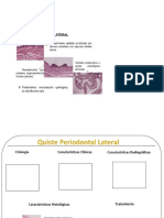 Quiste Periodontal Bosquejo