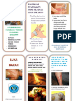 Leaflet Penanganan Luka Bakar