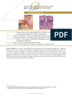 Acne Rosacea Diagnosis & Treatment
