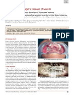 Bahan Pagets Disease of Maxilla