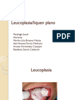 3.leucoplasia - Liquen Plano