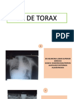 RX-ToRAX Placas Radiograficas