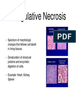 Coagulatice Necrosis.pptx