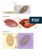 Fasciola Hepatica Egg