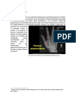 Huesos Sesamoasoideos y Neumaticos