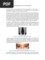 SÍNTOMAS DE LA ALCAPTONURIA.docx