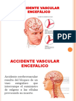 Accidente Vascular Encefálico