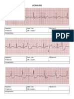 Latihan Ekg KD A III 2016