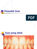 Penyakit Gusi1