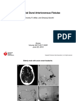 Intracranial Dural Arteriovenous Fistulae: by Timothy R. Miller, and Dheeraj Gandhi