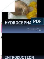 Everything You Need to Know About Hydrocephalus