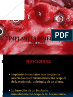 implantesinmediatospowerp-140813120010-phpapp01.pdf