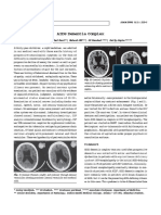 Aids Dementia Compleks PDF