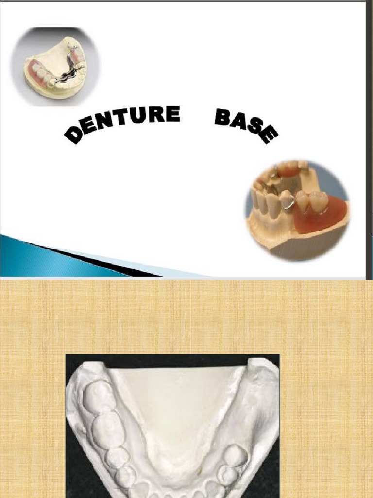 Denture Base Dentures Poly(Methyl Methacrylate)