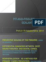 Preventive Sealing of The Fissures