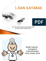 Katarak UMS