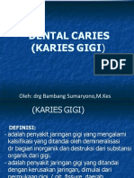 Karies Gigi