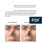 Penyakit Hidung dan Penanganannya