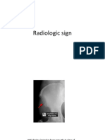 Radiologic Sign