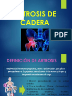 Artrosis de Cadera