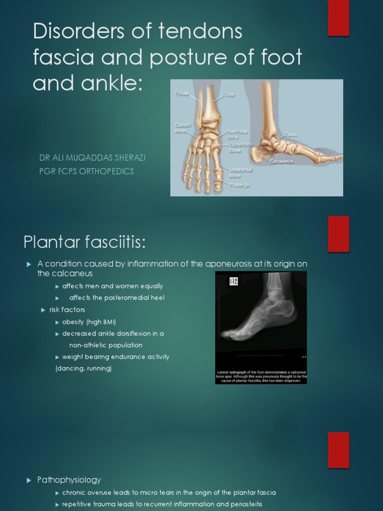 Tendon Disorders Of Foot And Ankle Autosaved2 Foot Ankle - 
