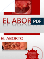 Aborto