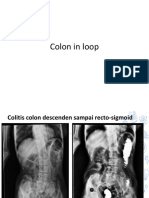 Colon in Loop