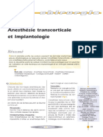 2004 Guillaume Anesthésie Transcorticale Et Implantologie Implantologie