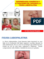 1 PRIMERA CLASE  Fisura labiopalatina.pptx