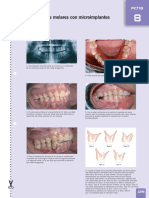 intrusaodemolares.pdf