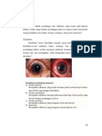 Uveitis