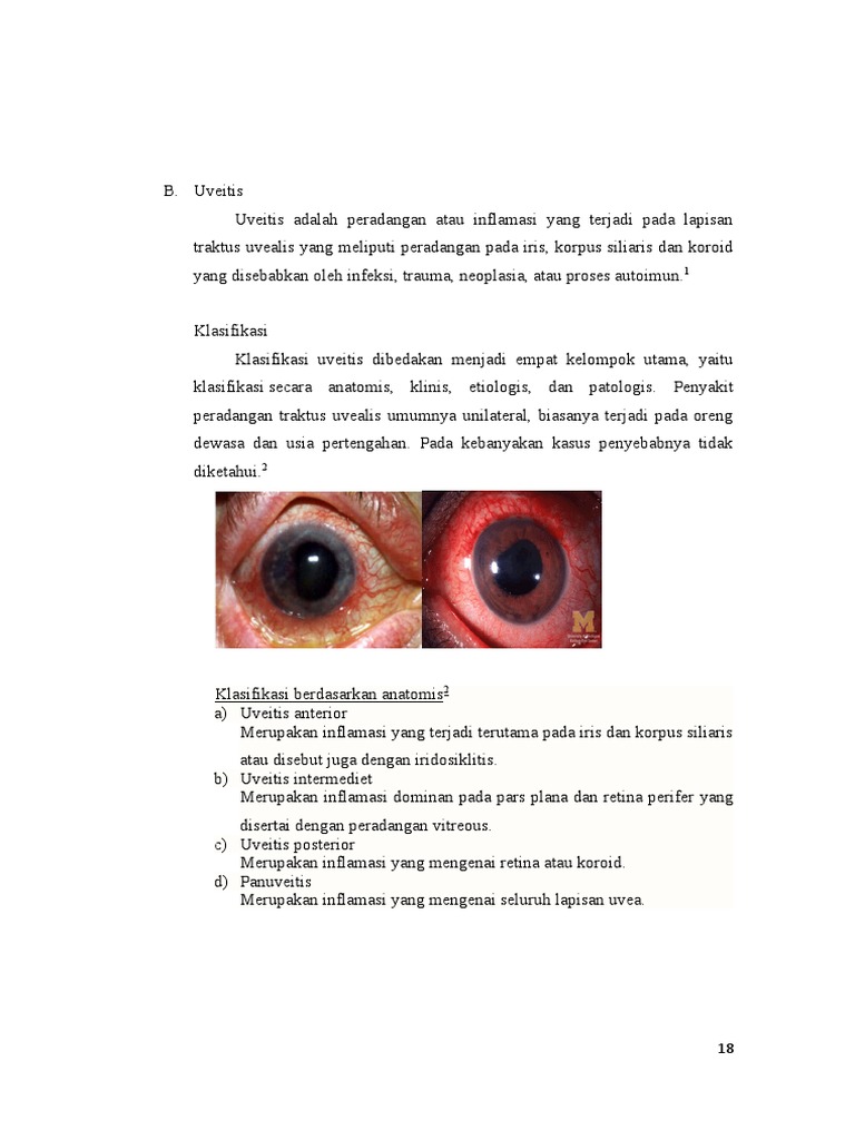 Klasifikasi dan Patofisiologi Uveitis | PDF