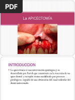 78053301-La-APICECTOMIA.pptx