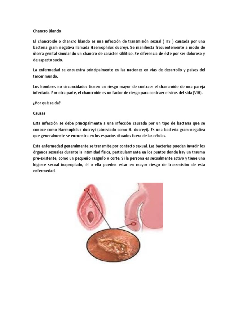 Chancro Blando - Enfermedades de Transmision Sexual | PDF