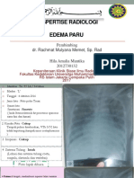 Edema Paru Radiologi