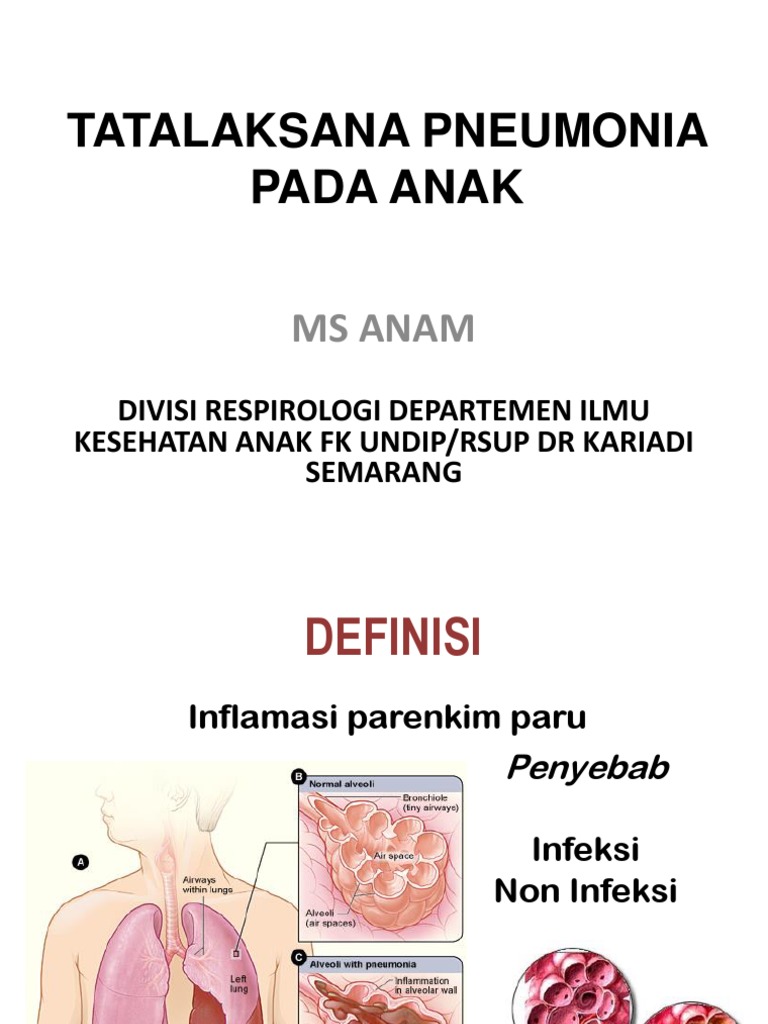 Tatalaksana Pneumonia pada Anak | PDF | Kesehatan Holistik | Sains ...