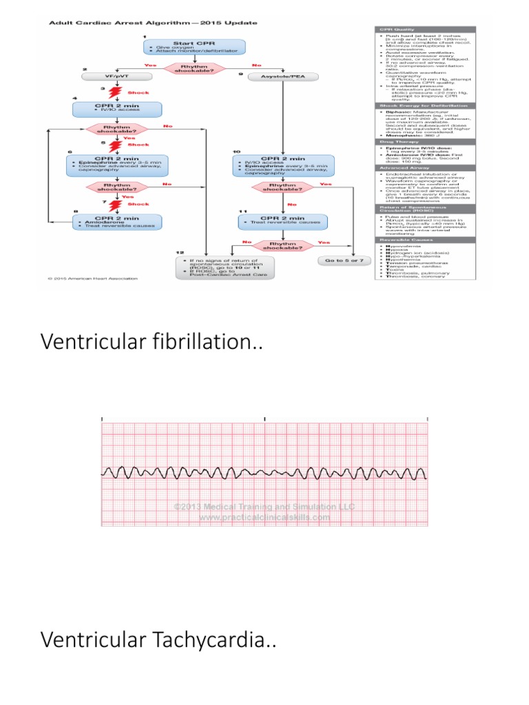 Algoritma ACLS | PDF