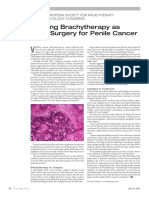 Organ Sparing Brachytherapy as Effective as.18