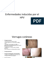 Enfermedades Inducidas por el VPH