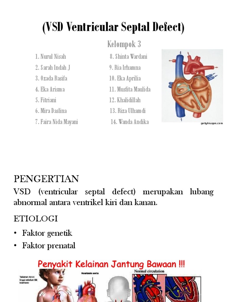 VSD Ventricular Septal Defect) | PDF