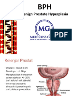 BPH Prostat Hipertrofi