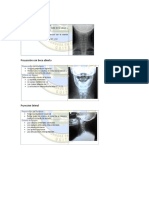 Columna Cervical