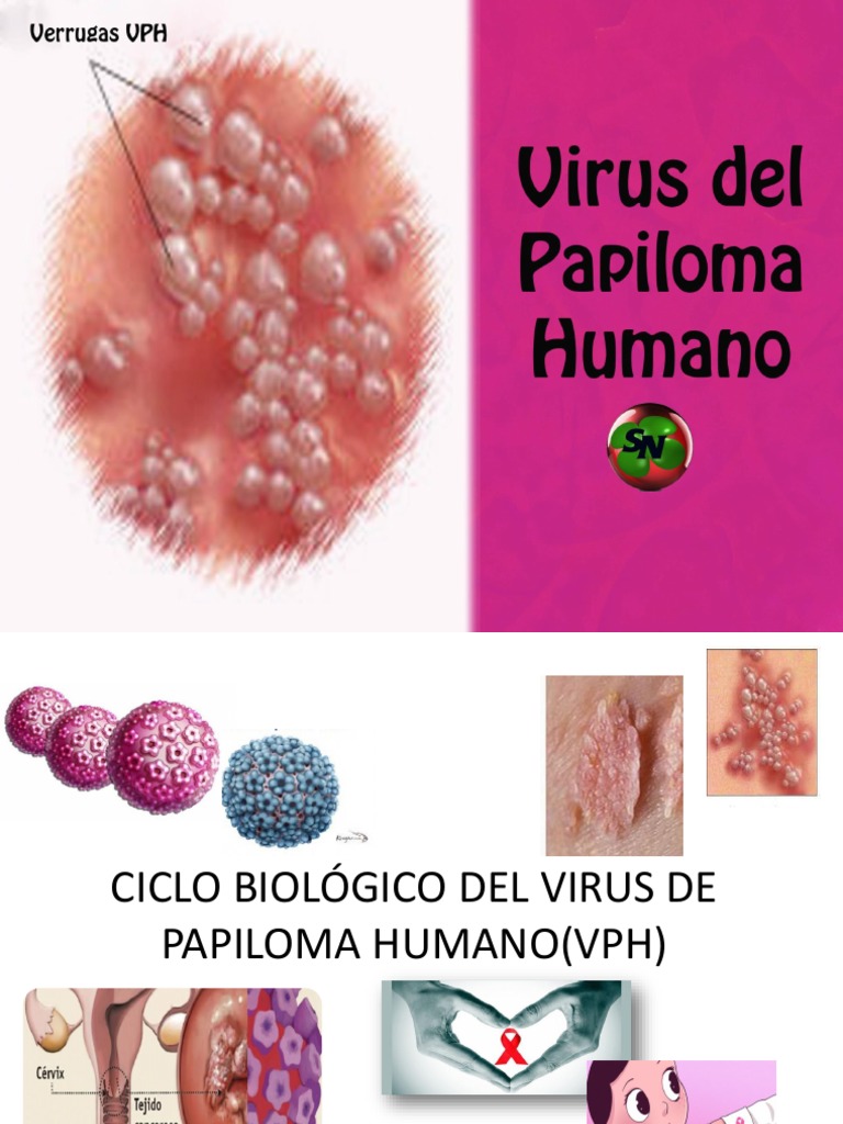 papiloma humano en hombres