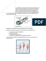 Bomba Linfática