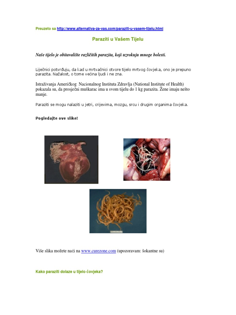 paraziták és tijelu slike enterobius vermicularis klinikai eset