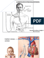Alimentación Nutricional Intensiva