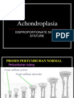 Achondroplasia: Disproportionate Short Stature