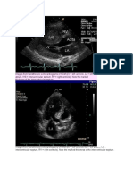 Images From Transthoracic Echocardiograms of HCM