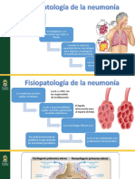 Neumonia